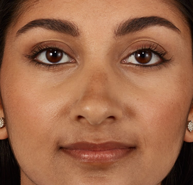 complexion after